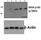 Nuclear Factor Kappa B Subunit 2 antibody, A01228S865-1, Boster Biological Technology, Western Blot image 