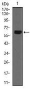 Keratin 5 antibody, MA5-17058, Invitrogen Antibodies, Western Blot image 
