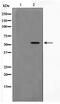 Dihydrouridine Synthase 2 antibody, TA347593, Origene, Western Blot image 