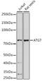 Autophagy Related 7 antibody, GTX32459, GeneTex, Western Blot image 