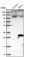 ADP Ribosylation Factor Like GTPase 11 antibody, NBP1-88990, Novus Biologicals, Western Blot image 