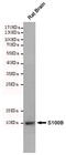 S100 Calcium Binding Protein B antibody, STJ99307, St John