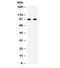 CD22 Molecule antibody, R32000, NSJ Bioreagents, Western Blot image 