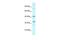 TATA-Box Binding Protein Associated Factor, RNA Polymerase I Subunit A antibody, GTX77768, GeneTex, Western Blot image 