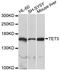 Tet Methylcytosine Dioxygenase 3 antibody, A7612, ABclonal Technology, Western Blot image 