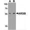 Arylsulfatase B antibody, MBS153676, MyBioSource, Western Blot image 