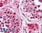 Replication Protein A3 antibody, LS-B1711, Lifespan Biosciences, Immunohistochemistry paraffin image 