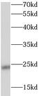 StAR Related Lipid Transfer Domain Containing 5 antibody, FNab08291, FineTest, Western Blot image 