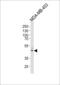 IL-5R-alpha antibody, 61-848, ProSci, Western Blot image 