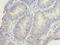 DNA Damage Inducible 1 Homolog 2 antibody, LS-C399190, Lifespan Biosciences, Immunohistochemistry paraffin image 