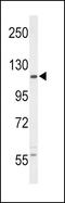 Colony Stimulating Factor 1 Receptor antibody, PA5-25974, Invitrogen Antibodies, Western Blot image 