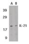 Interleukin-21 antibody, PA5-19981, Invitrogen Antibodies, Western Blot image 