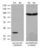Galectin 3 antibody, LS-C796799, Lifespan Biosciences, Western Blot image 