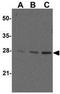 ADP Ribosylation Factor Like GTPase 6 Interacting Protein 1 antibody, GTX85516, GeneTex, Western Blot image 