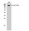 Catenin Delta 1 antibody, A02333Y228-1, Boster Biological Technology, Western Blot image 