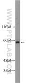 BTB Domain Containing 16 antibody, 24733-1-AP, Proteintech Group, Western Blot image 
