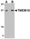 Transmembrane Protein 18 antibody, 5043, ProSci, Western Blot image 