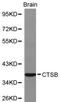 Cathepsin B antibody, LS-C192290, Lifespan Biosciences, Western Blot image 