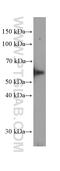 Solute carrier family 45 member 3 antibody, 60343-1-Ig, Proteintech Group, Western Blot image 