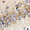 Parkin RBR E3 Ubiquitin Protein Ligase antibody, LS-C368456, Lifespan Biosciences, Immunohistochemistry paraffin image 