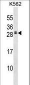 Heparin Binding EGF Like Growth Factor antibody, LS-C166802, Lifespan Biosciences, Western Blot image 