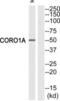 Coronin 1A antibody, abx013461, Abbexa, Western Blot image 