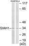 Siah E3 Ubiquitin Protein Ligase 1 antibody, EKC1866, Boster Biological Technology, Western Blot image 