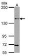 Homeodomain Interacting Protein Kinase 3 antibody, PA5-28809, Invitrogen Antibodies, Western Blot image 