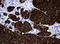 MAGE Family Member A3 antibody, LS-C789002, Lifespan Biosciences, Immunohistochemistry paraffin image 
