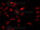 Heterogeneous Nuclear Ribonucleoprotein F antibody, A5505, ABclonal Technology, Immunofluorescence image 