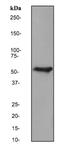 Keratin 6A antibody, ab93279, Abcam, Western Blot image 