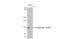 Protein Tyrosine Kinase 2 antibody, GTX132140, GeneTex, Western Blot image 