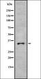 Olfactory Receptor Family 2 Subfamily G Member 6 antibody, orb336431, Biorbyt, Western Blot image 