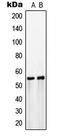 Solute Carrier Family 2 Member 3 antibody, LS-C352851, Lifespan Biosciences, Western Blot image 