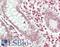 Ras Association Domain Family Member 2 antibody, LS-B14691, Lifespan Biosciences, Immunohistochemistry paraffin image 