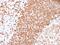 Mesothelin antibody, GTX02676, GeneTex, Immunohistochemistry paraffin image 