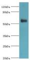 Poly [ADP-ribose] polymerase 3 antibody, LS-C376271, Lifespan Biosciences, Western Blot image 