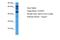 Coiled-Coil Alpha-Helical Rod Protein 1 antibody, A07174, Boster Biological Technology, Western Blot image 