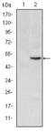 Methylenetetrahydrofolate Reductase antibody, M00336, Boster Biological Technology, Western Blot image 