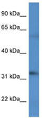 Beta,beta-carotene 9 ,10 -oxygenase antibody, TA342995, Origene, Western Blot image 