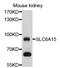 Solute Carrier Family 6 Member 15 antibody, STJ112468, St John