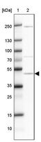 Zona Pellucida Glycoprotein 3 antibody, PA5-62907, Invitrogen Antibodies, Western Blot image 