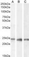 Progesterone Receptor Membrane Component 1 antibody, GTX89362, GeneTex, Western Blot image 