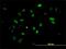 Checkpoint Kinase 2 antibody, H00011200-M01, Novus Biologicals, Immunocytochemistry image 