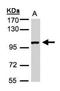 ABR Activator Of RhoGEF And GTPase antibody, NBP1-30981, Novus Biologicals, Western Blot image 