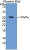 Interleukin 12B antibody, MBS2026324, MyBioSource, Western Blot image 
