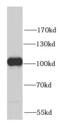 Glycogen phosphorylase, brain form antibody, FNab06973, FineTest, Western Blot image 