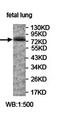 Arachidonate Lipoxygenase 3 antibody, orb78009, Biorbyt, Western Blot image 