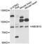 ATP Binding Cassette Subfamily B Member 10 antibody, LS-C748814, Lifespan Biosciences, Western Blot image 