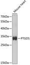 Prostaglandin D2 Synthase antibody, GTX55765, GeneTex, Western Blot image 